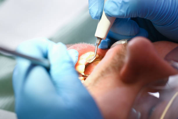 Best Emergency Treatment for Jaw Pain or Injury in El Macero, CA