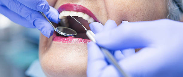 Best Emergency Wisdom Tooth Extraction in El Macero, CA